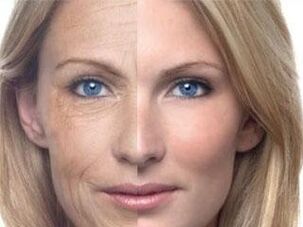 pigmentation de la peau