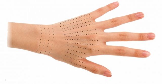 Sites d'injection pour les mains lors de la bio-revitalisation